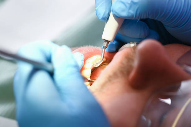 Best Emergency Treatment for Dental Infections or Abscesses in Shanor Northvue, PA
