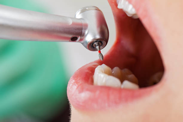Best After-Hours Dental Trauma Care in Shanor Northvue, PA